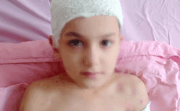 Sokak köpeklerinin saldırısına uğrayan çocuk psikolojik sorunlar yaşıyor