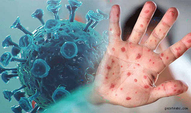 11 soruda maymun çiçeği