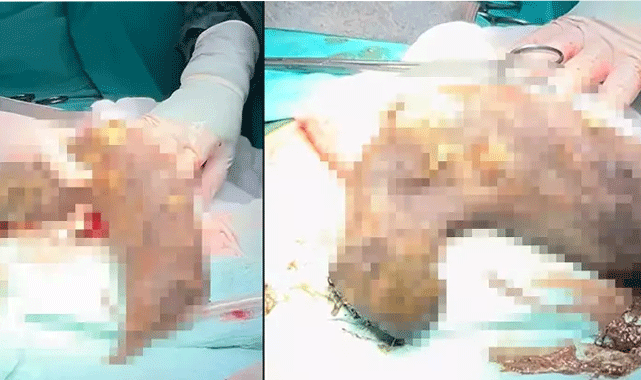 Doktorlar bile gördüğüne inanamadı