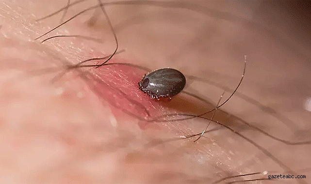 Kene kaynaklı yeni virüs keşfedildi