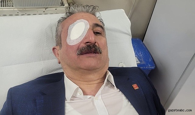 CHP İl Başkanı Yeşiltaş Protesto Sırasında Yaralandı