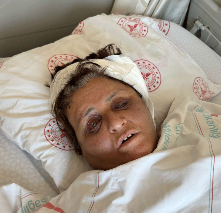 Gelin kaynanasını tuğlayla dövdü!