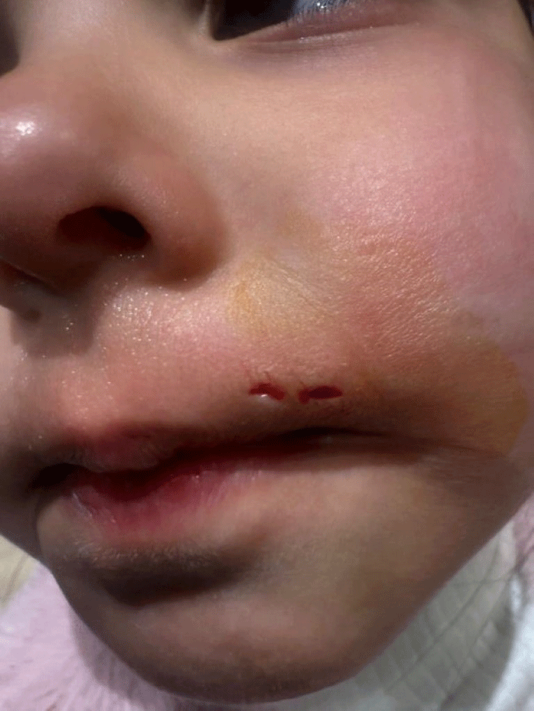 İzmir'de sahipsiz köpek dehşeti