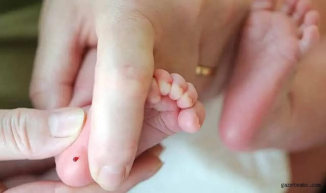 TOPUK KANI TESTİ UYARISI