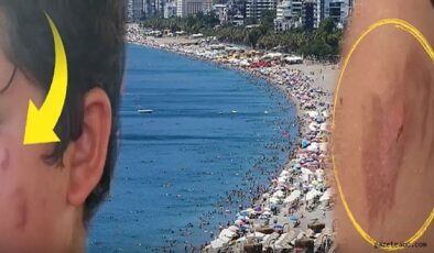 Uzmanlardan Deniz Uyarısı