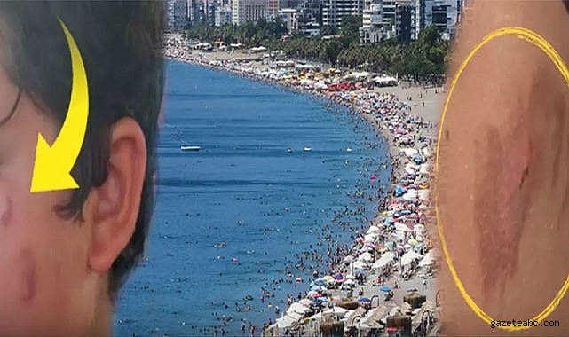 Uzmanlardan Deniz Uyarısı