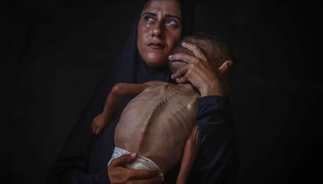 Gazze’nin Sesi Türkiye’den Ödül Aldı