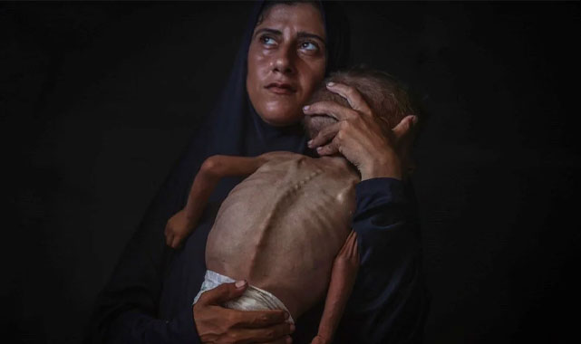 Gazze’nin Sesi Türkiye’den Ödül Aldı