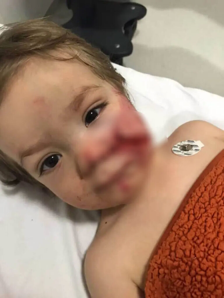 Ankara'da pitbull dehşeti