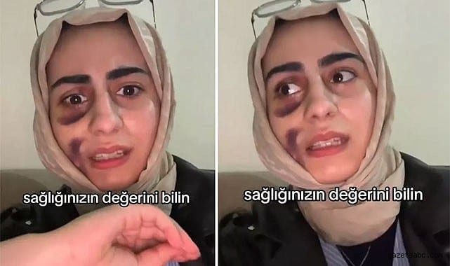 “Tedavi Mağduriyeti Sosyal Medyada Patladı”