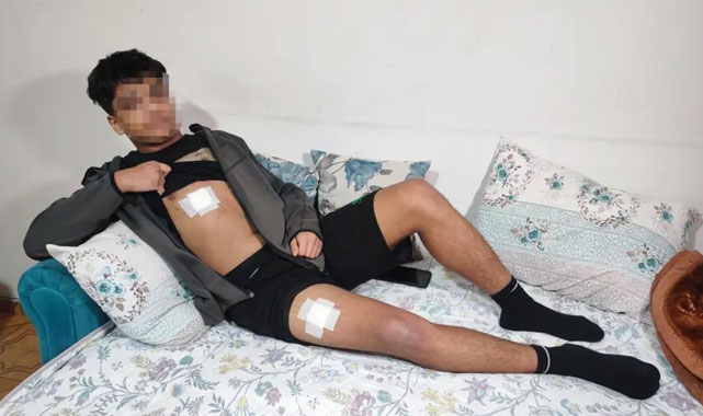 15 Yaşındaki Çocuğa Bıçaklı Saldırı