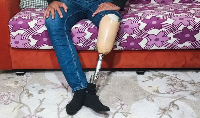 Bacağını Kaybeden Adamın Hapis Riski